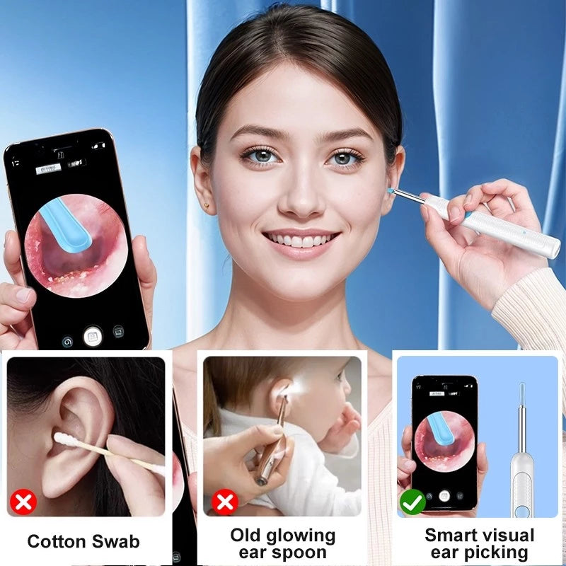 ClearPro Kit Pembersih Telinga Pintar